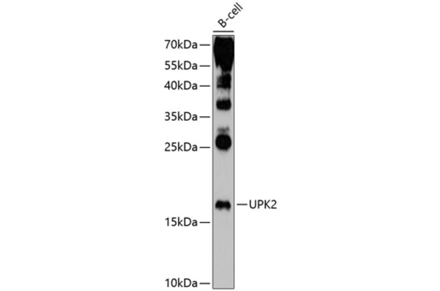 Western Blot - Anti-Uroplakin II/UPII Antibody (A8807) - Antibodies.com