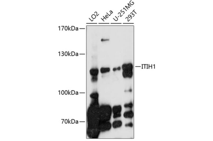 Western Blot - Anti-ITIH1 Antibody (A10833) - Antibodies.com