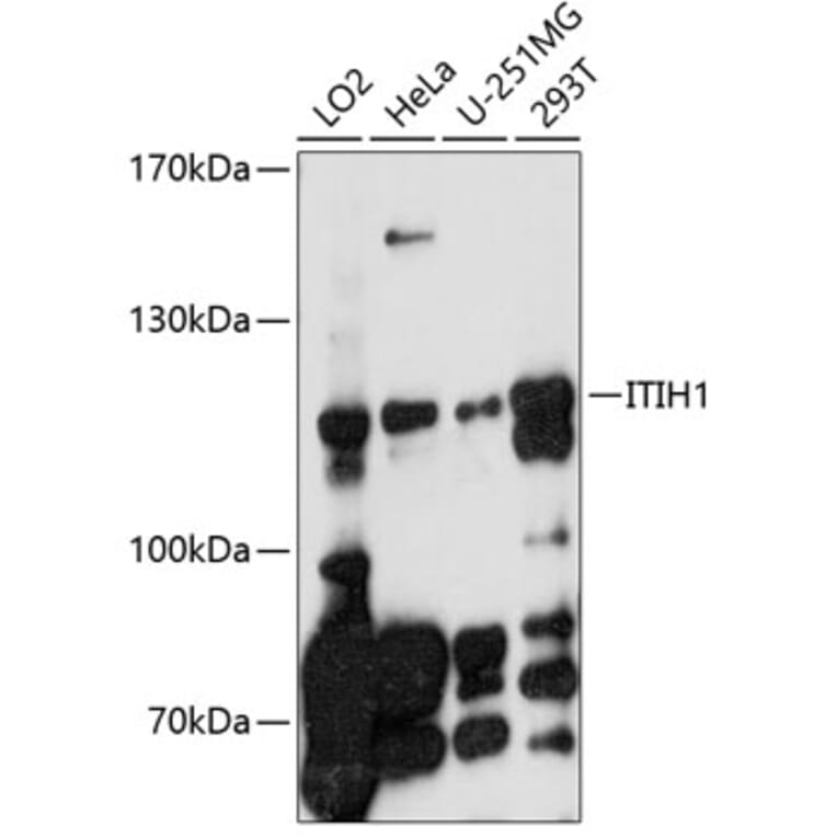 Western Blot - Anti-ITIH1 Antibody (A10833) - Antibodies.com