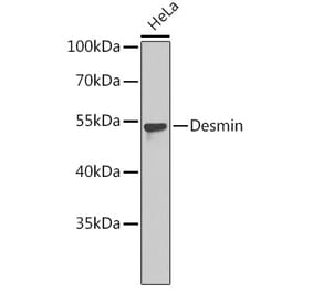 Western Blot - Anti-Desmin Antibody (A8809) - Antibodies.com