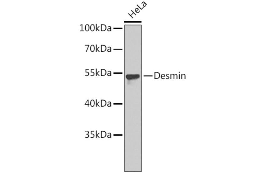 Western Blot - Anti-Desmin Antibody (A8809) - Antibodies.com
