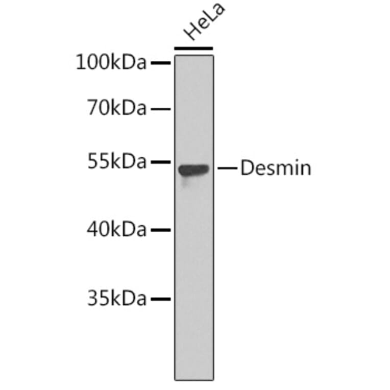 Western Blot - Anti-Desmin Antibody (A8809) - Antibodies.com