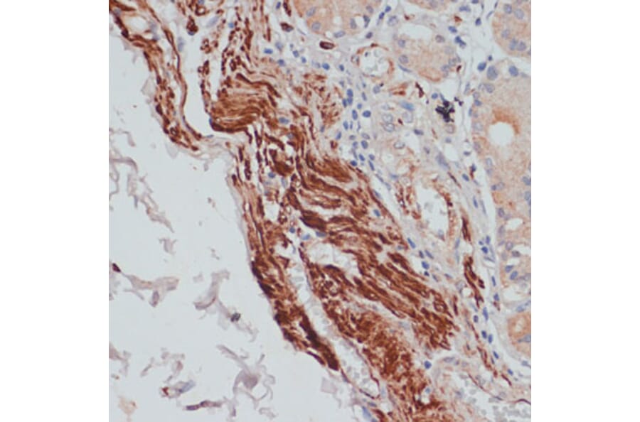 Immunohistochemistry - Anti-Desmin Antibody (A8809) - Antibodies.com