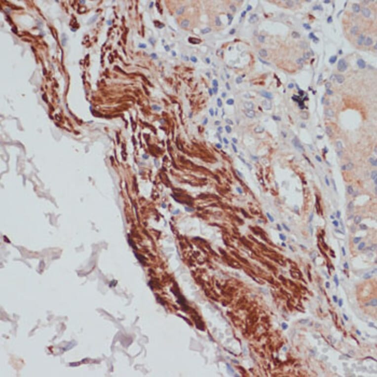 Immunohistochemistry - Anti-Desmin Antibody (A8809) - Antibodies.com