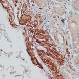 Immunohistochemistry - Anti-Desmin Antibody (A8809) - Antibodies.com