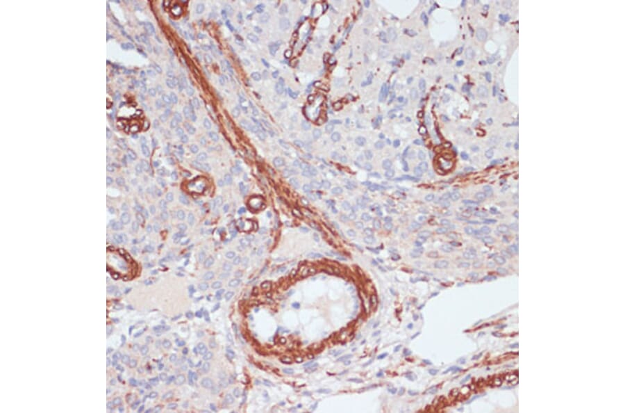 Immunohistochemistry - Anti-Desmin Antibody (A8809) - Antibodies.com