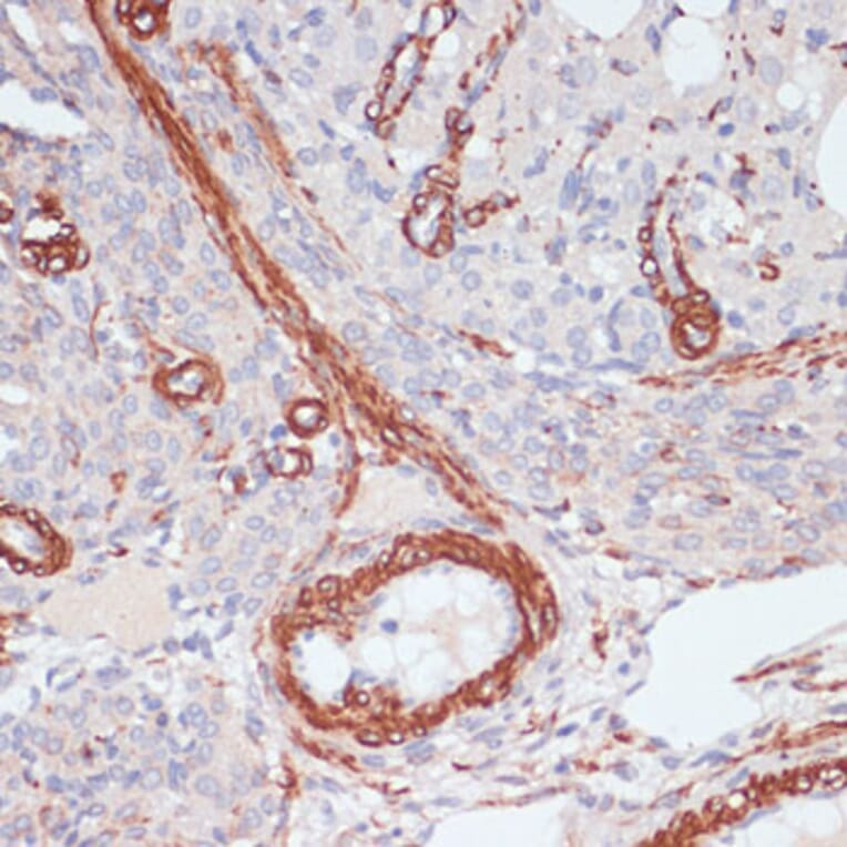 Immunohistochemistry - Anti-Desmin Antibody (A8809) - Antibodies.com