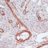 Immunohistochemistry - Anti-Desmin Antibody (A8809) - Antibodies.com