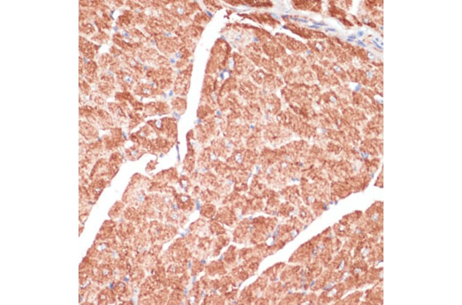 Immunohistochemistry - Anti-Desmin Antibody (A8809) - Antibodies.com