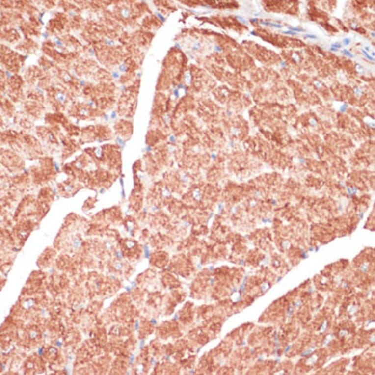 Immunohistochemistry - Anti-Desmin Antibody (A8809) - Antibodies.com