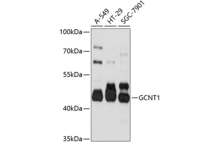 Western Blot - Anti-GCNT1 Antibody (A10842) - Antibodies.com