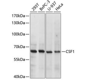 Western Blot - Anti-M-CSF Antibody (A8811) - Antibodies.com