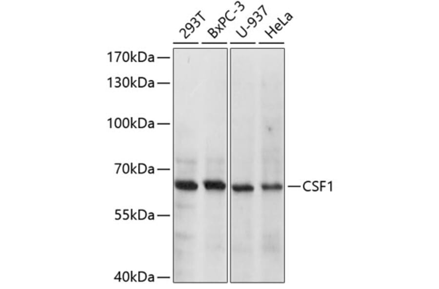 Western Blot - Anti-M-CSF Antibody (A8811) - Antibodies.com