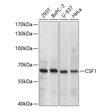 Western Blot - Anti-M-CSF Antibody (A8811) - Antibodies.com