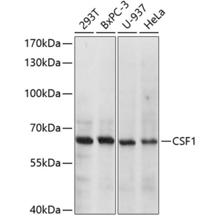 Western Blot - Anti-M-CSF Antibody (A8811) - Antibodies.com