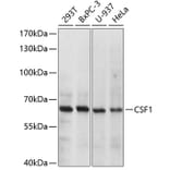Western Blot - Anti-M-CSF Antibody (A8811) - Antibodies.com