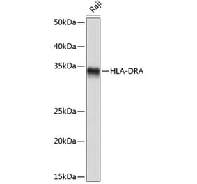 Western Blot - Anti-HLA-DR Antibody [ARC0518] (A8814) - Antibodies.com