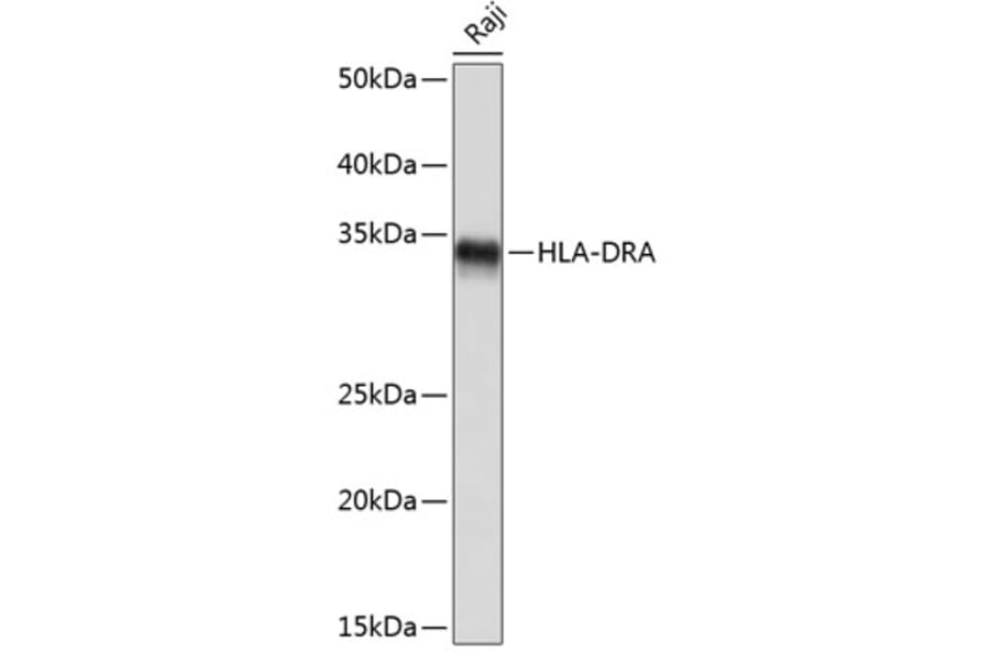 Western Blot - Anti-HLA-DR Antibody [ARC0518] (A8814) - Antibodies.com