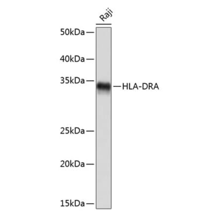Western Blot - Anti-HLA-DR Antibody [ARC0518] (A8814) - Antibodies.com