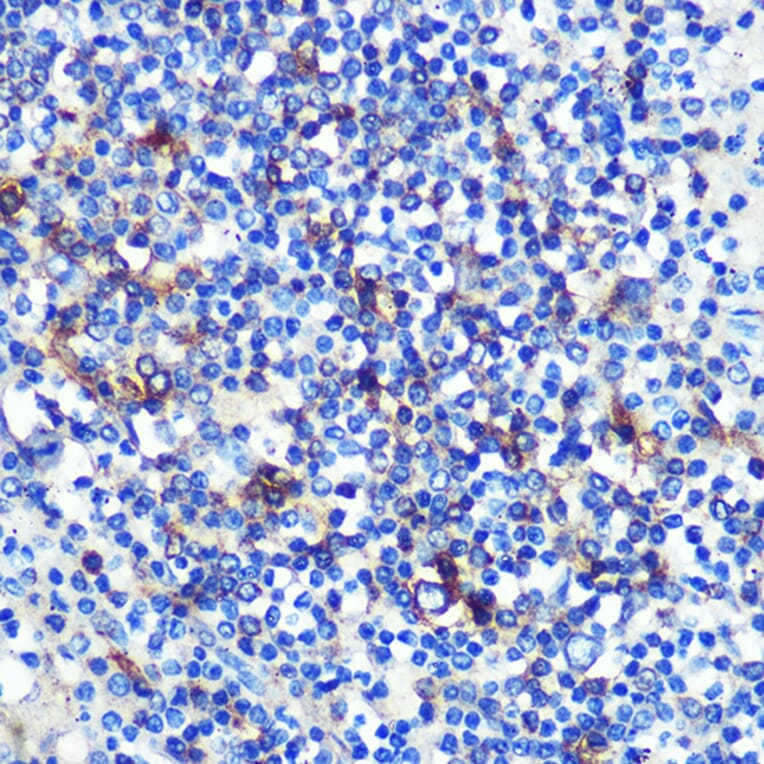 Immunohistochemistry - Anti-HLA-DR Antibody [ARC0518] (A8814) - Antibodies.com