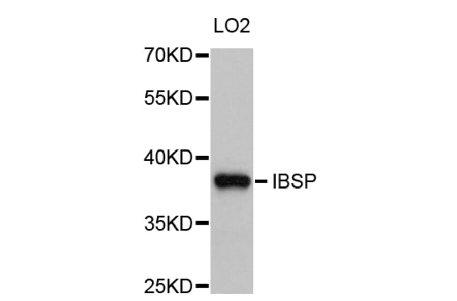 Western Blot - Anti-IBSP Antibody (A10867) - Antibodies.com