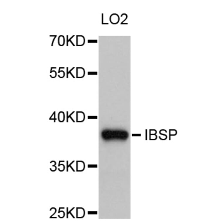 Western Blot - Anti-IBSP Antibody (A10867) - Antibodies.com