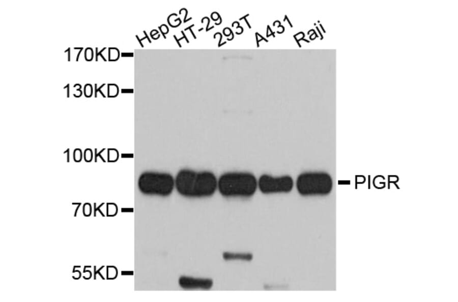 Western Blot - Anti-PIGR Antibody (A10881) - Antibodies.com