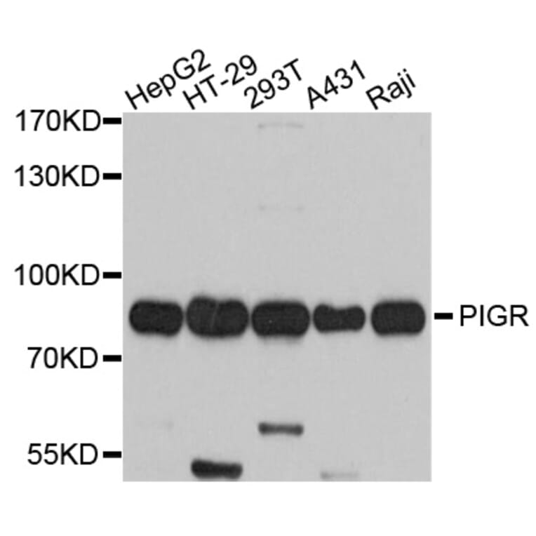 Western Blot - Anti-PIGR Antibody (A10881) - Antibodies.com