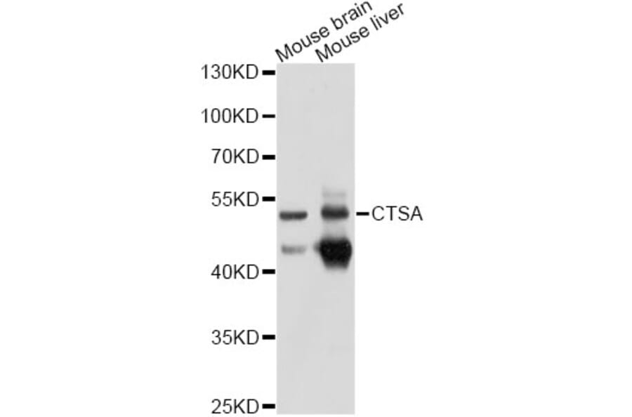Western Blot - Anti-CTSA Antibody (A10884) - Antibodies.com