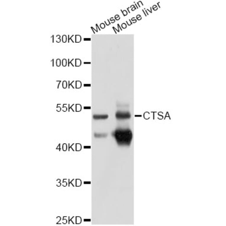 Western Blot - Anti-CTSA Antibody (A10884) - Antibodies.com