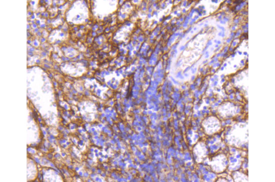 Immunohistochemistry - Anti-ICAM1 Antibody (A10907) - Antibodies.com