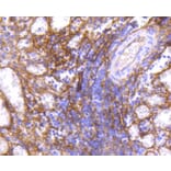 Immunohistochemistry - Anti-ICAM1 Antibody (A10907) - Antibodies.com