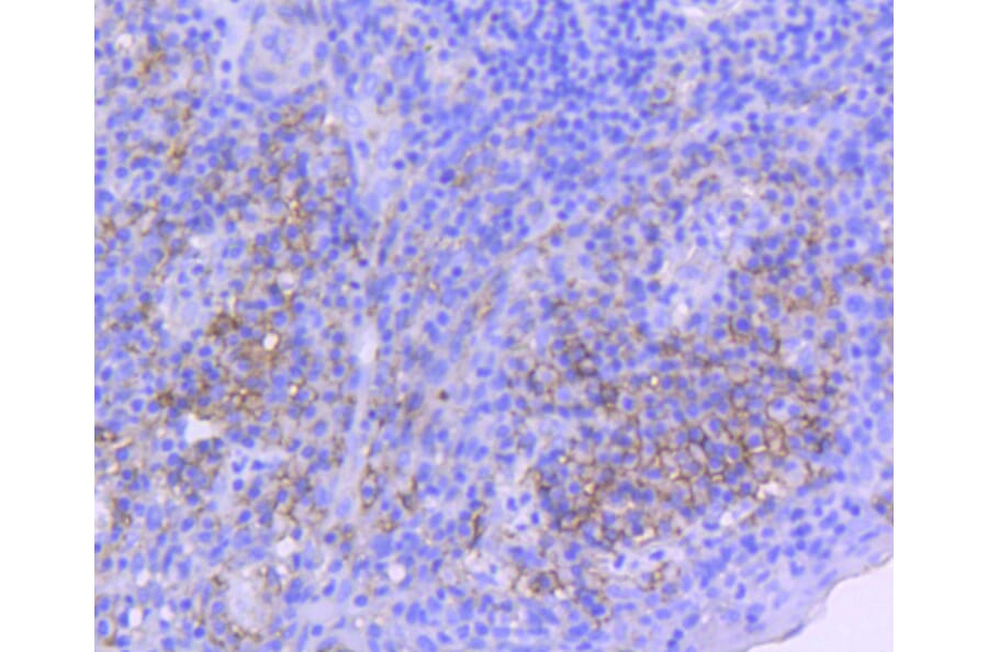 Immunohistochemistry - Anti-ICAM1 Antibody (A10907) - Antibodies.com