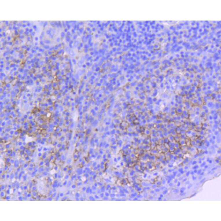 Immunohistochemistry - Anti-ICAM1 Antibody (A10907) - Antibodies.com