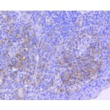 Immunohistochemistry - Anti-ICAM1 Antibody (A10907) - Antibodies.com