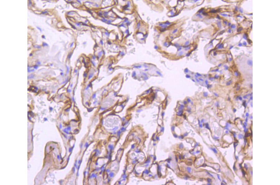 Immunohistochemistry - Anti-ICAM1 Antibody (A10907) - Antibodies.com