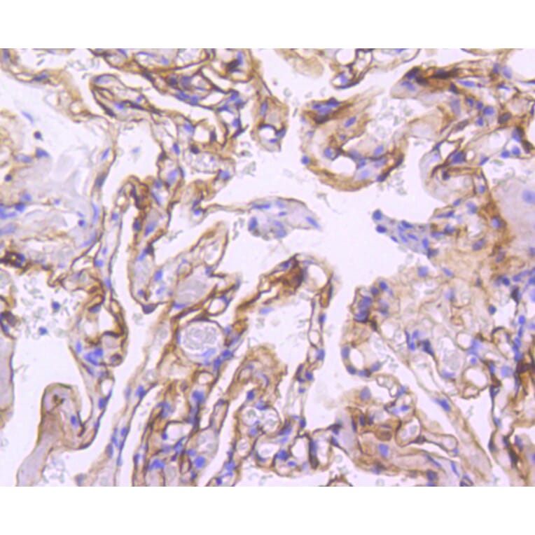Immunohistochemistry - Anti-ICAM1 Antibody (A10907) - Antibodies.com