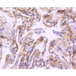Immunohistochemistry - Anti-ICAM1 Antibody (A10907) - Antibodies.com