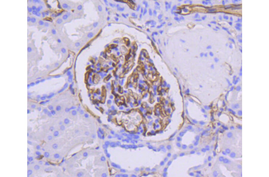 Immunohistochemistry - Anti-ICAM1 Antibody (A10907) - Antibodies.com