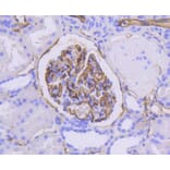 Immunohistochemistry - Anti-ICAM1 Antibody (A10907) - Antibodies.com