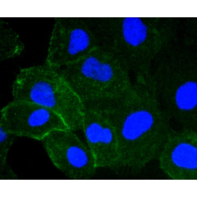 Immunofluorescence - Anti-ICAM1 Antibody (A10907) - Antibodies.com