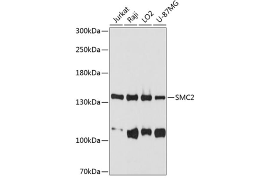 Western Blot - Anti-SMC2 Antibody (A10908) - Antibodies.com