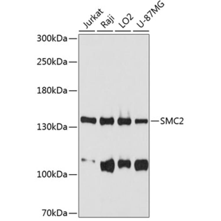 Western Blot - Anti-SMC2 Antibody (A10908) - Antibodies.com