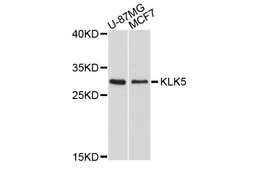 Western Blot - Anti-KLK5 Antibody (A10917) - Antibodies.com