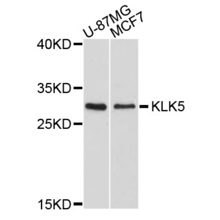 Western Blot - Anti-KLK5 Antibody (A10917) - Antibodies.com