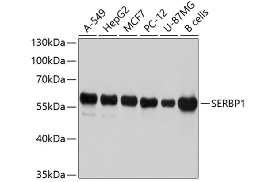 Western Blot - Anti-SERBP1 Antibody (A10923) - Antibodies.com