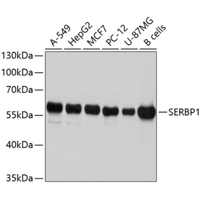 Western Blot - Anti-SERBP1 Antibody (A10923) - Antibodies.com