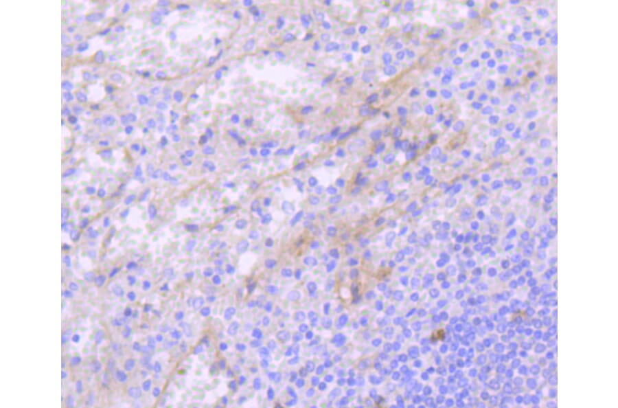 Immunohistochemistry - Anti-KIT Antibody (A10933) - Antibodies.com