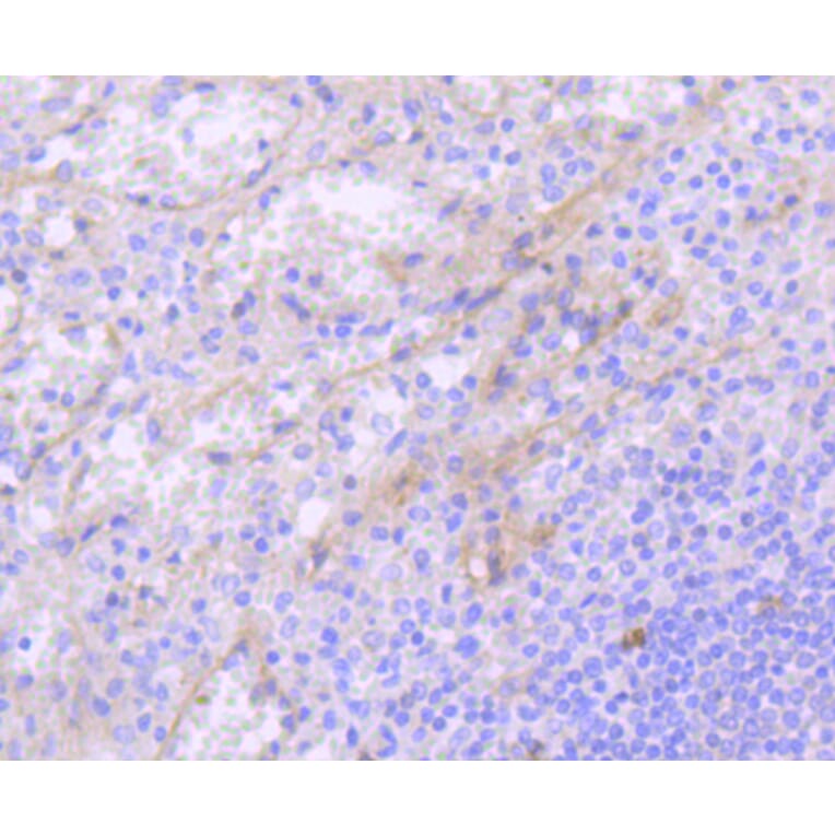 Immunohistochemistry - Anti-KIT Antibody (A10933) - Antibodies.com
