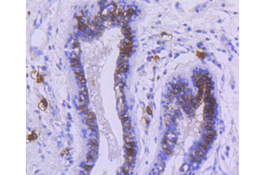 Immunohistochemistry - Anti-KIT Antibody (A10933) - Antibodies.com